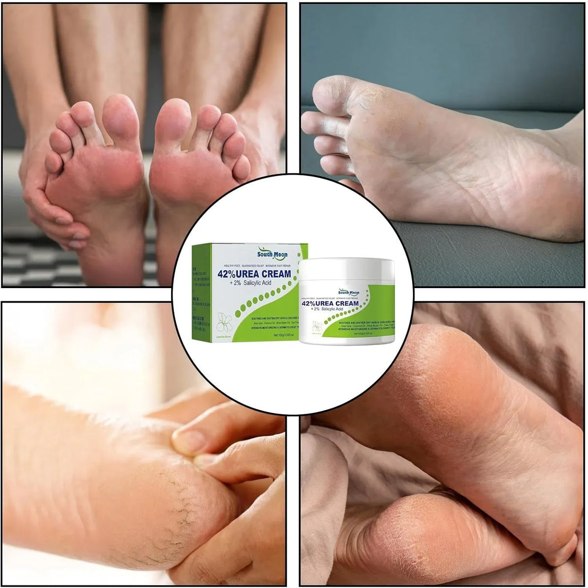 South Moon - 42% Urea Cream + 2% Salicylic Acid